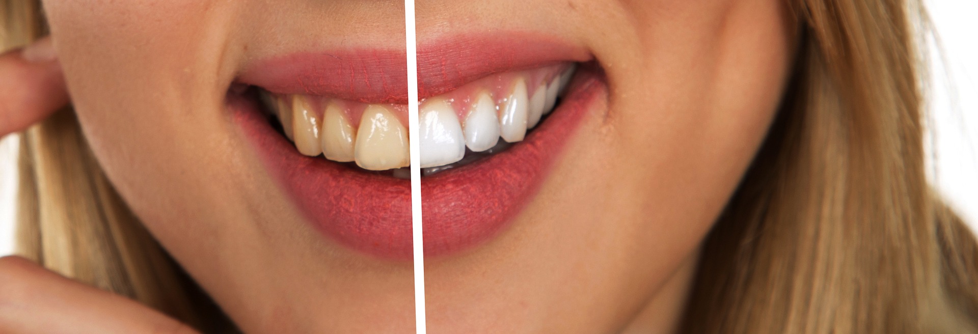 Co jeść i jak dbać o zęby by by były zdrowe i białe?